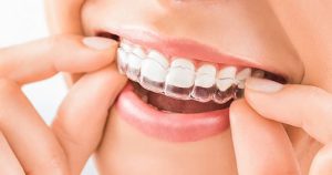 بند محافظ دندان چگونه از بروز عفونت مقاربتی جلوگیری میکند